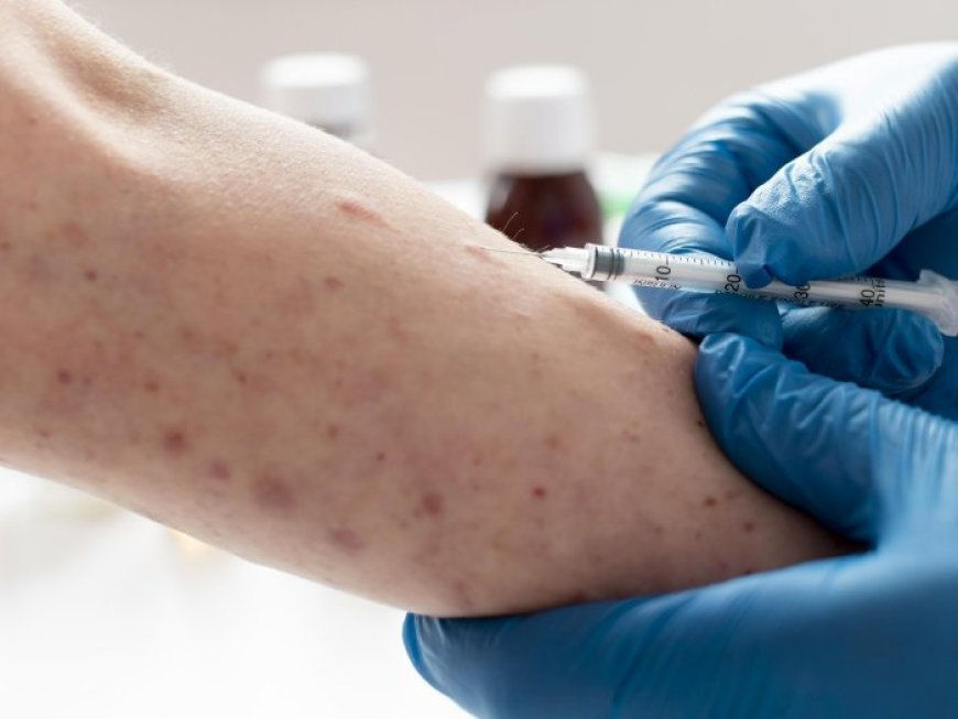 Waspada Campak Jelang Lebaran, Ini Tips Perkuat Langkah Pencegahan