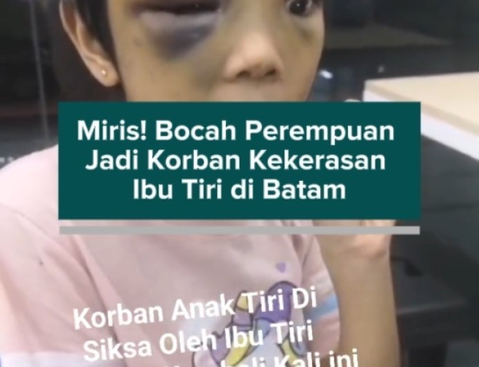 Miris! Bocah Perempuan Jadi Korban Kekerasan Ibu Tiri di Batam
